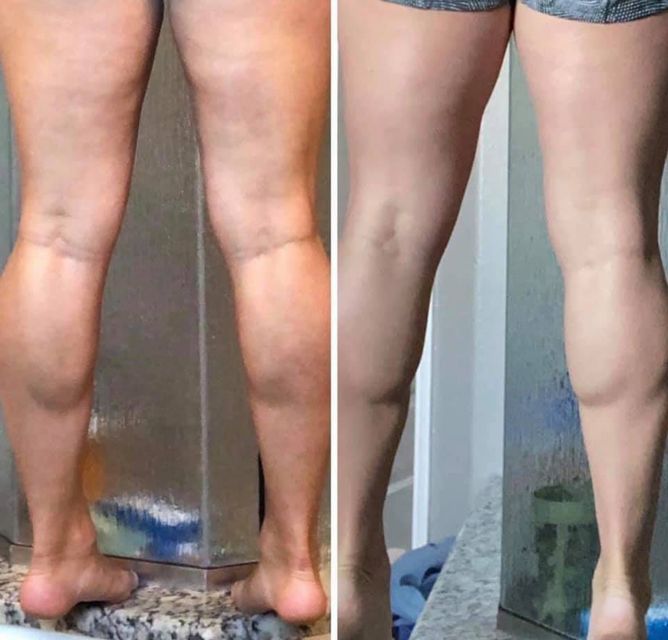 Dermatic Effects - Cellulite Firming Cream