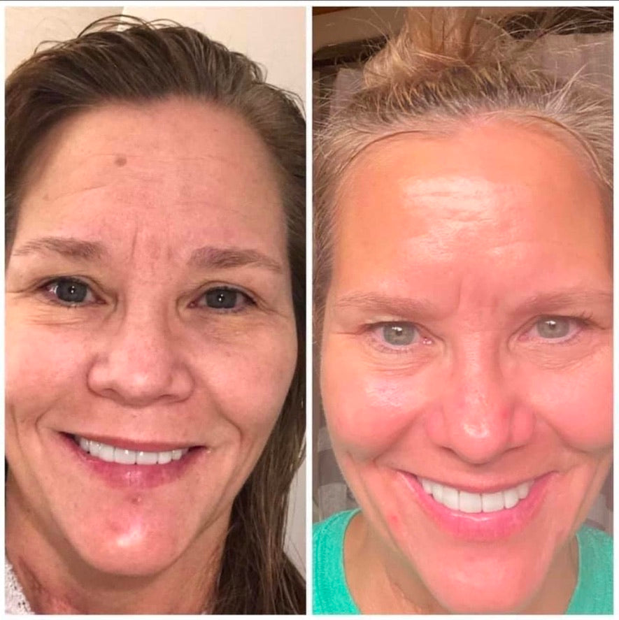 LumiSpa iO Essentials Kit
