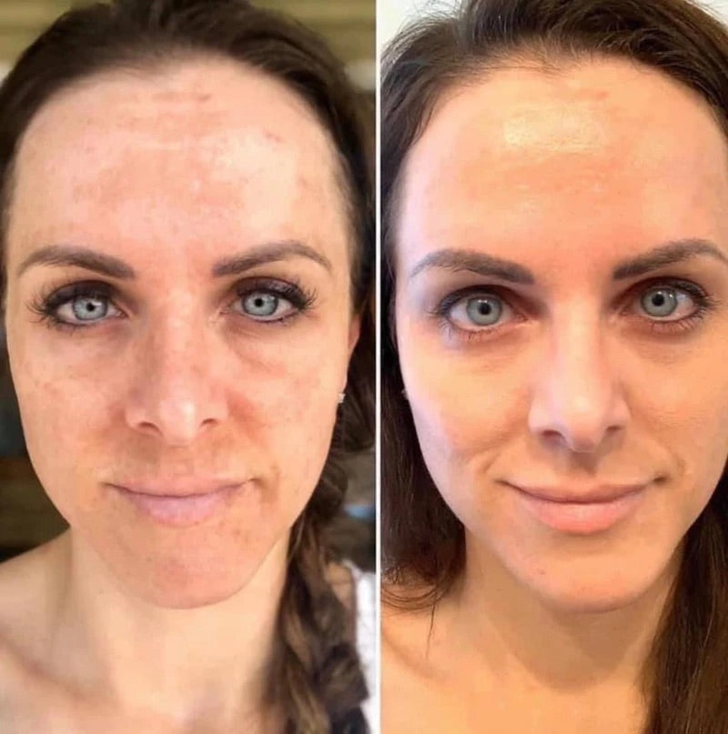 180 Vitamin C Face Wash