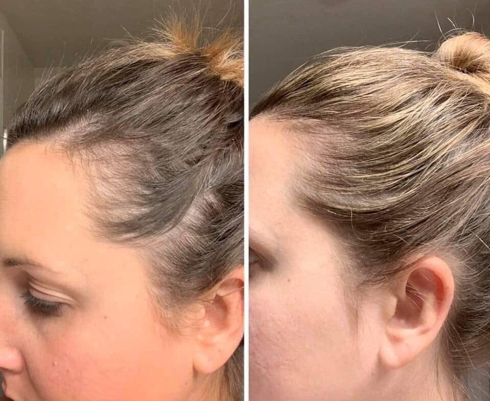AgeLOC Hair & Scalp Shampoo & Conditioner
