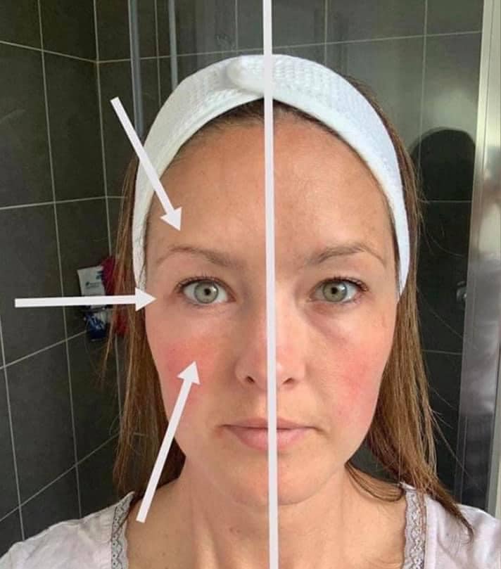 LumiSpa iO Eye Accent Attachment