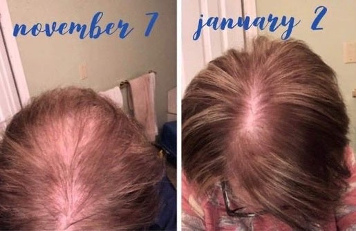 AgeLOC Hair & Scalp Shampoo & Conditioner