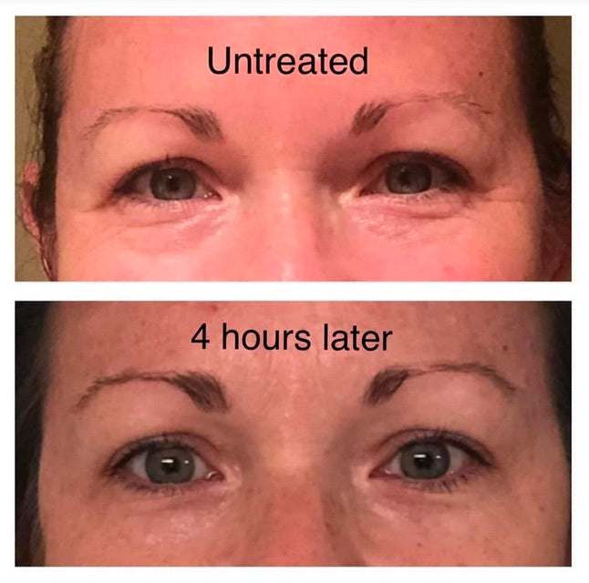 LumiSpa iO Eye Accent Attachment