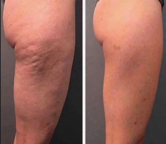 Dermatic Effects - Cellulite Firming Cream