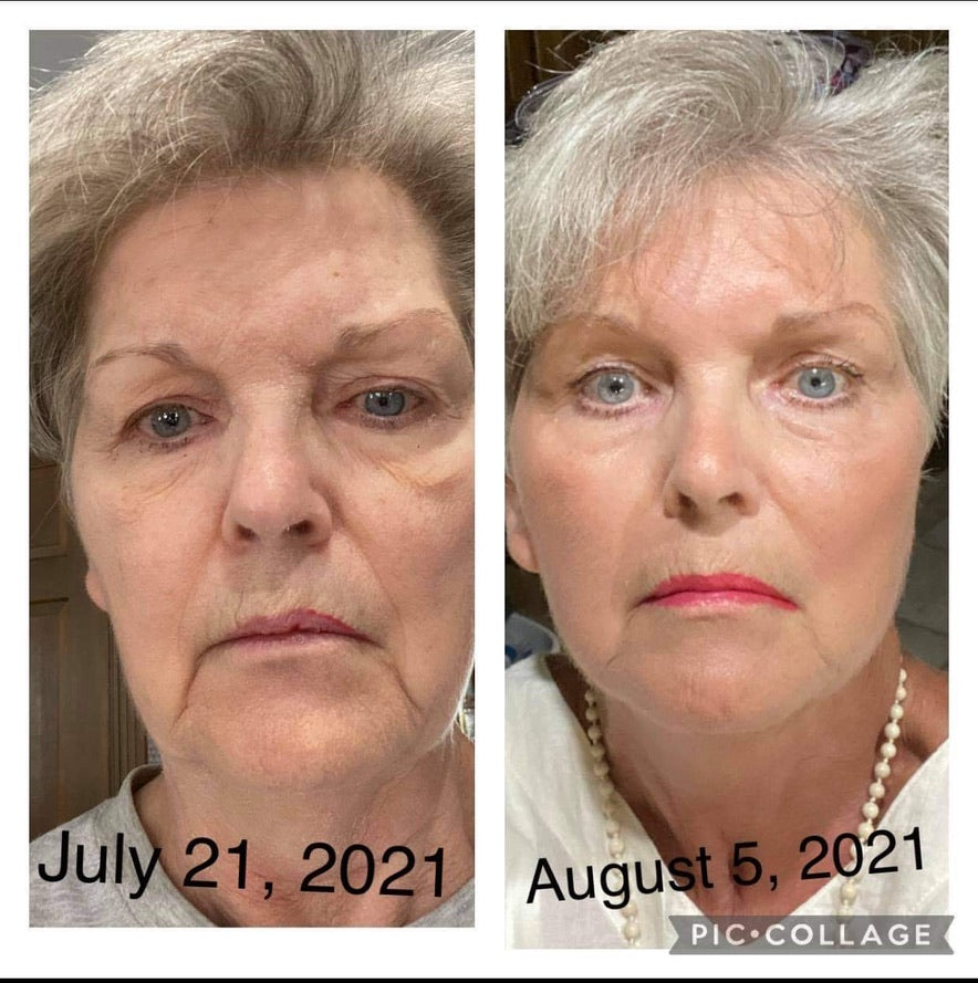 Beauty Focus Collagen+