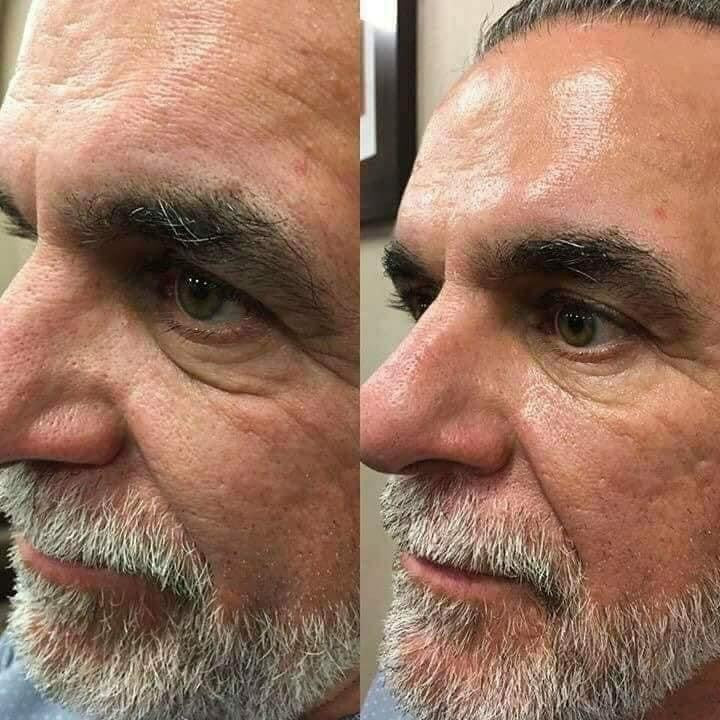 Facial Spa