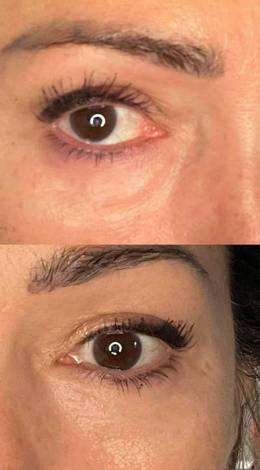 Eye Love Bright Eyes