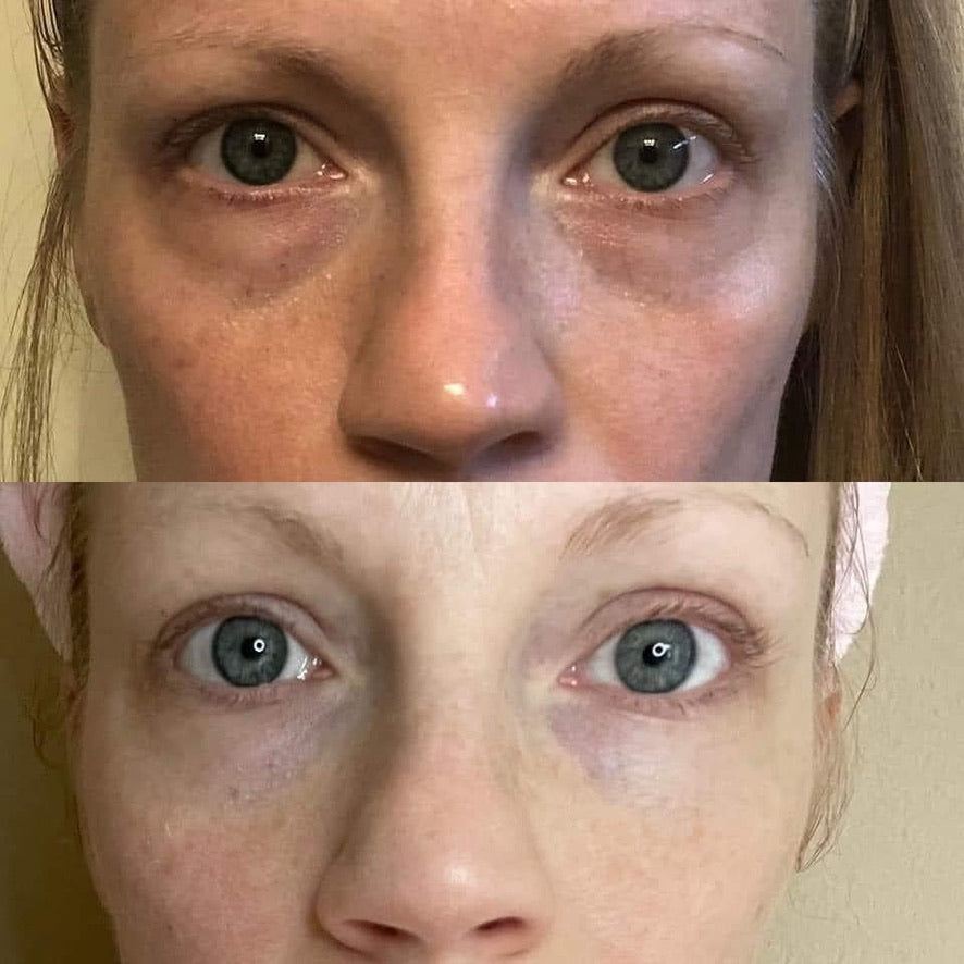 LumiSpa iO Eye Accent Attachment