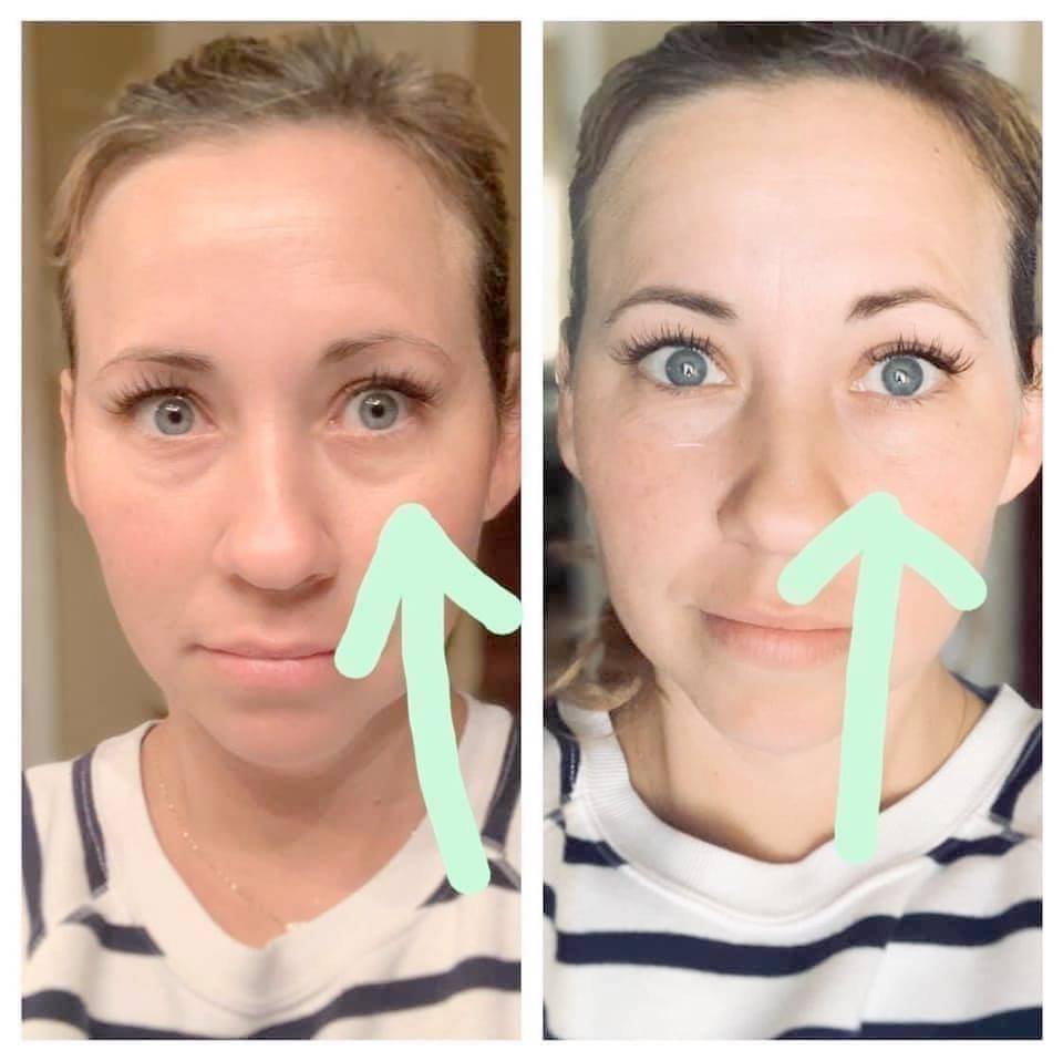 AgeLoc Ideal Eyes
