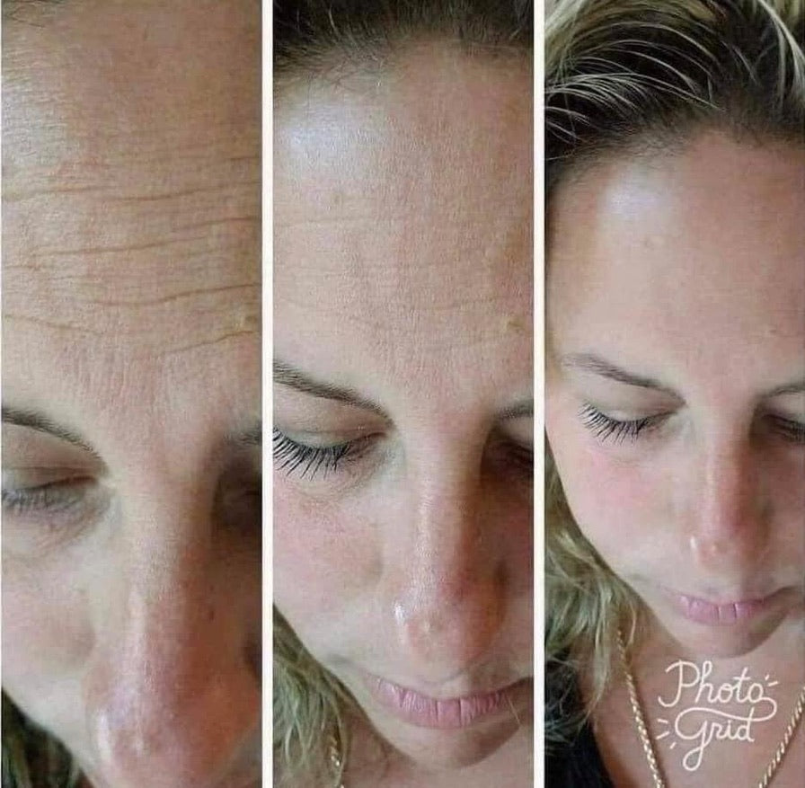 Tru Face Line Corrector