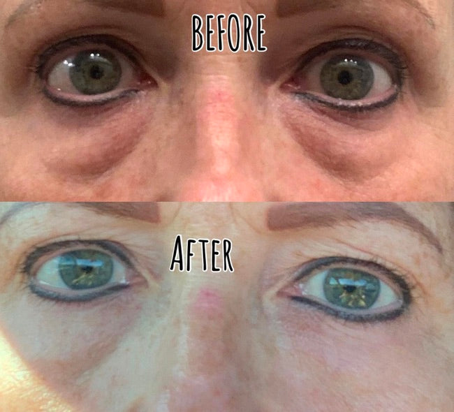 LumiSpa iO Eye Accent Attachment