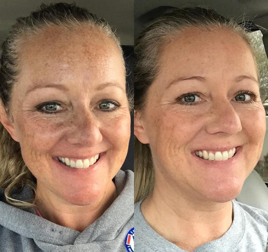 Nutricentials Bakuchiol Pump Serum