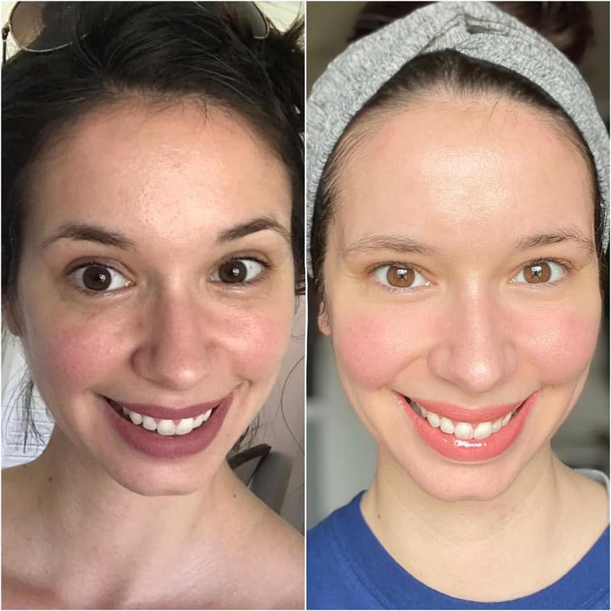 LumiSpa iO Essentials Kit