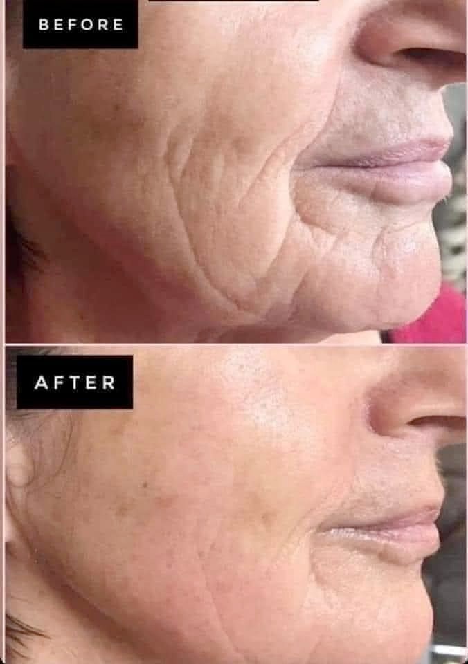Tru Face Essence Ultra Anti-Aging Serum