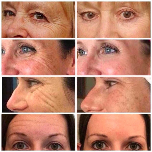 Tru Face Essence Ultra Anti-Aging Serum