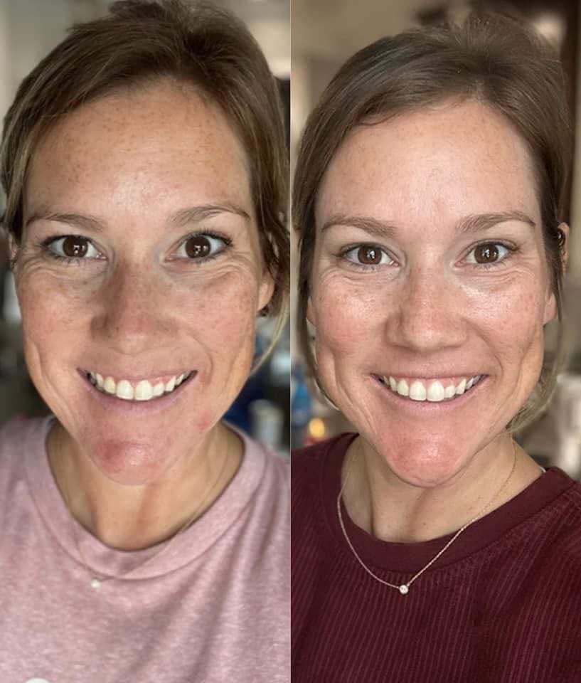 Vitamin C + Collagen Pump