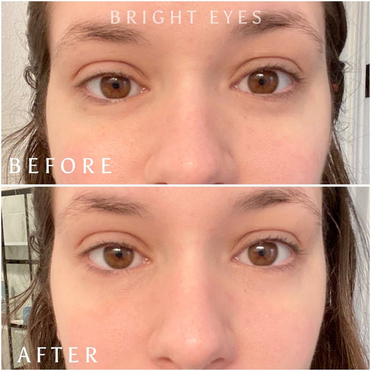 Eye Love Bright Eyes