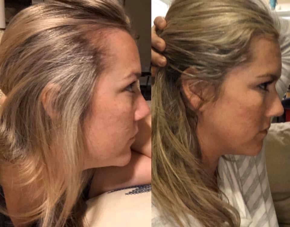 AgeLOC Hair & Scalp Shampoo & Conditioner