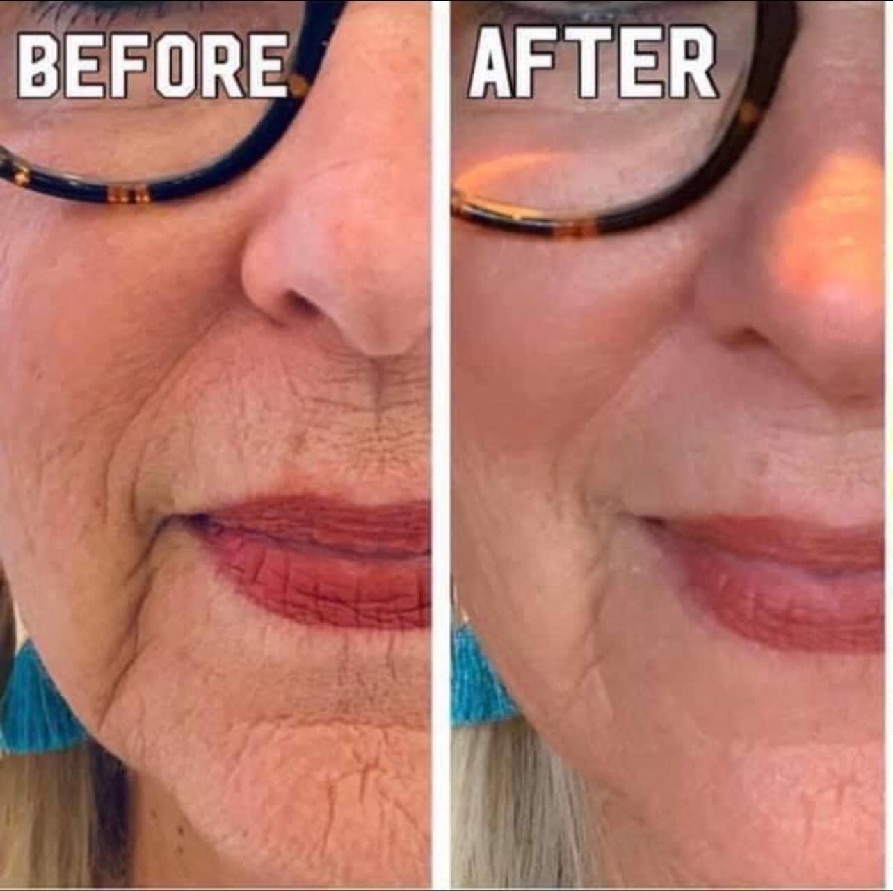 Tru Face Essence Ultra Anti-Aging Serum