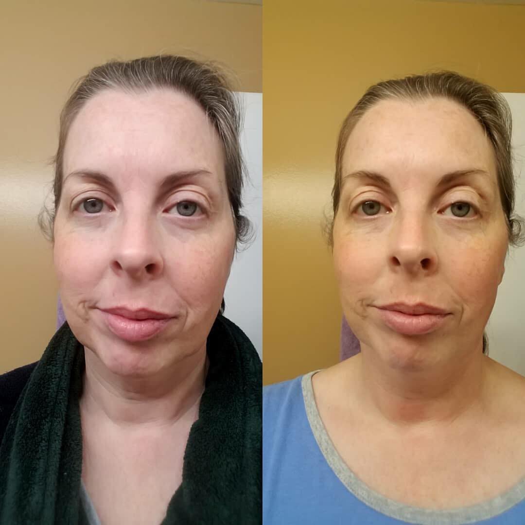 Facial Spa