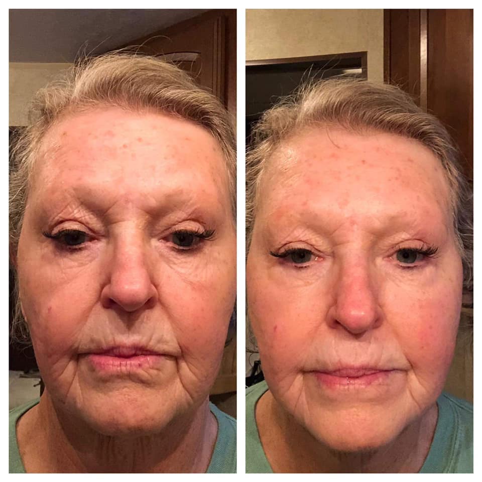 Facial Spa