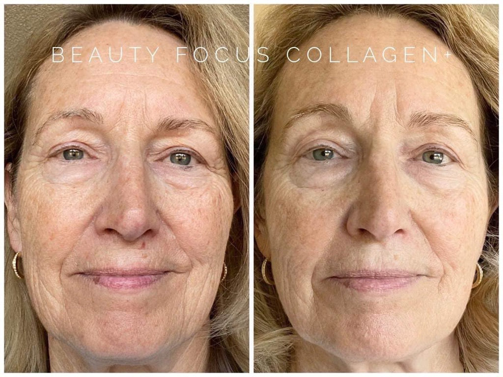 Beauty Focus Collagen+