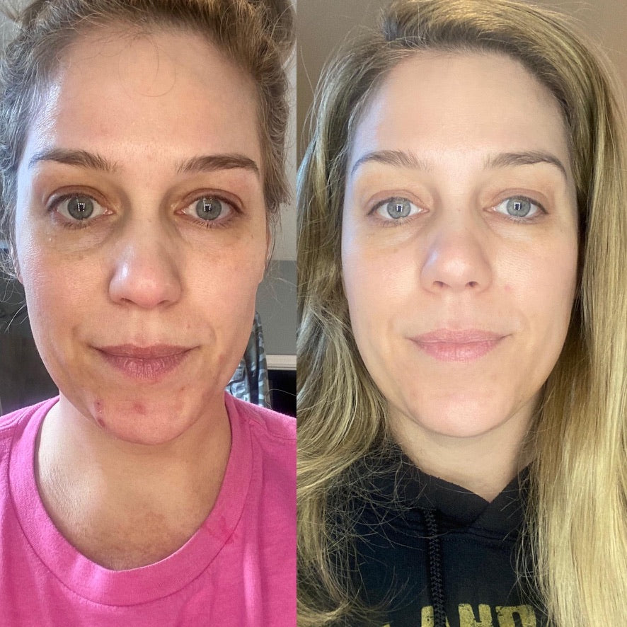 180 Vitamin C Face Wash