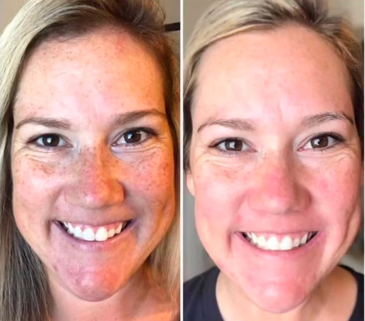 180 Vitamin C Face Wash