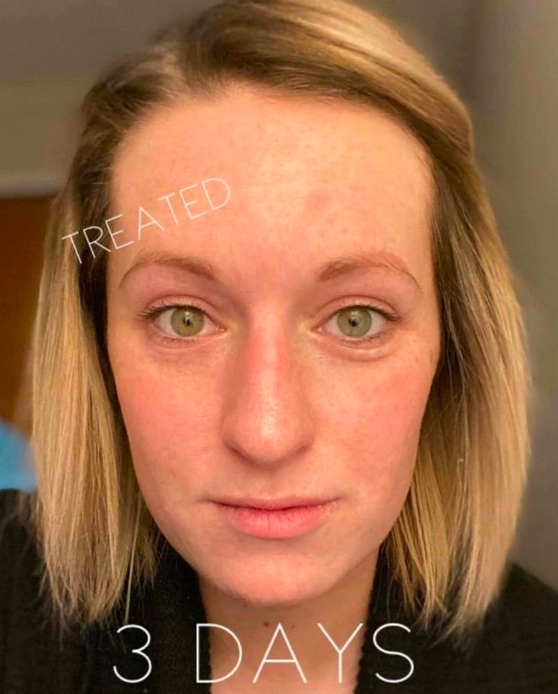 AgeLoc Ideal Eyes