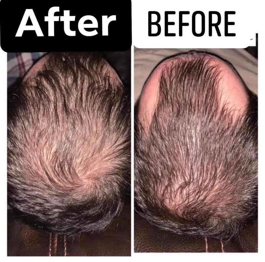 AgeLOC Hair & Scalp Shampoo & Conditioner
