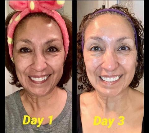 180 AHA Facial Peel and Neutralizer