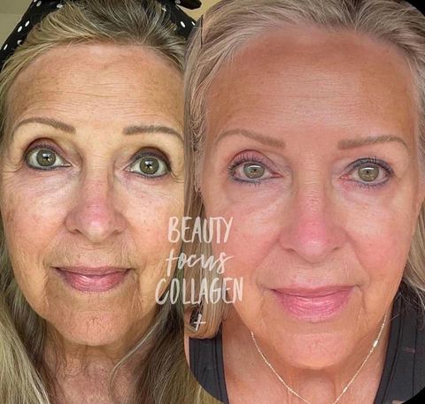 Beauty Focus Collagen+