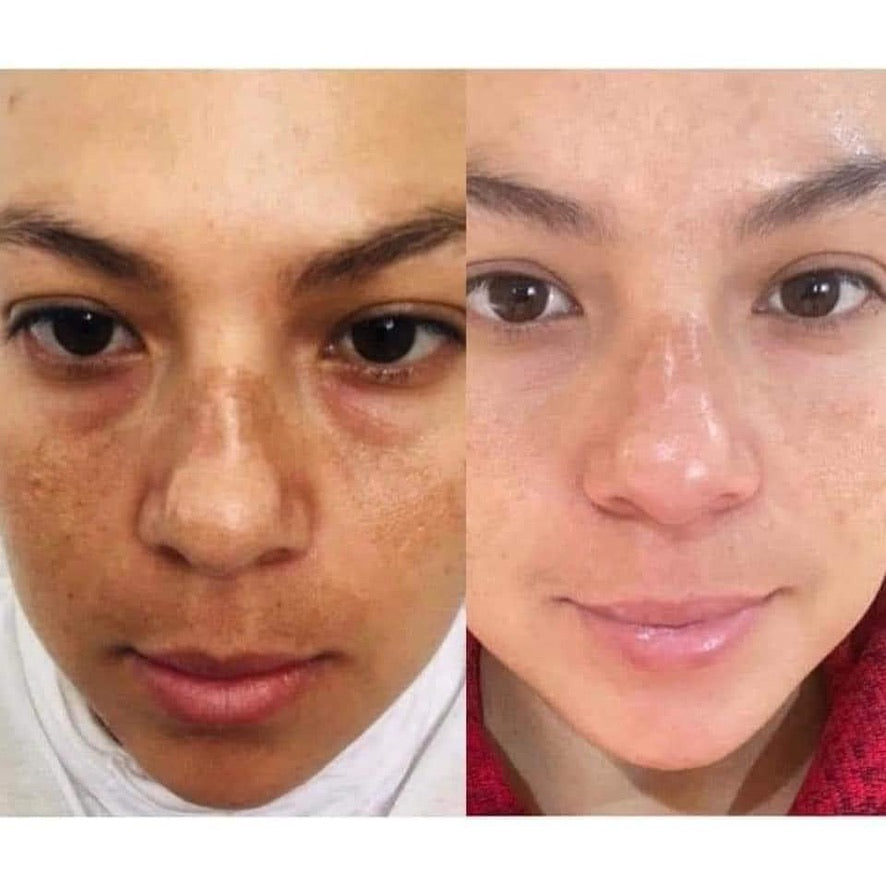 180 Vitamin C Face Wash