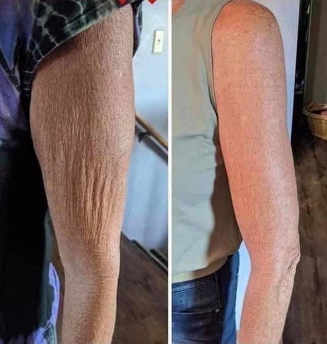 Dermatic Effects - Cellulite Firming Cream