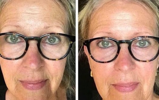 180 AHA Facial Peel and Neutralizer