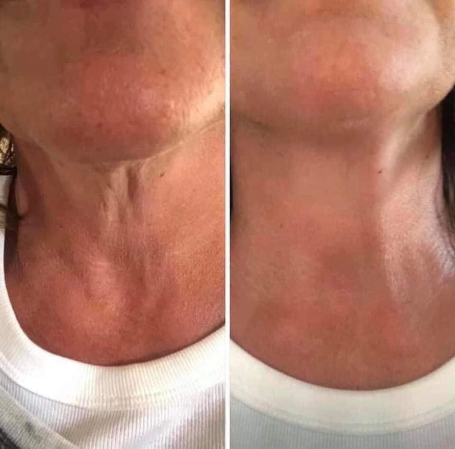 Dermatic Effects - Cellulite Firming Cream