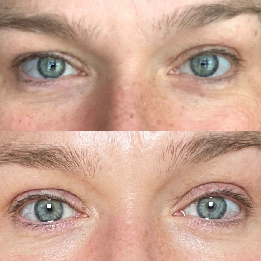 AgeLoc Ideal Eyes