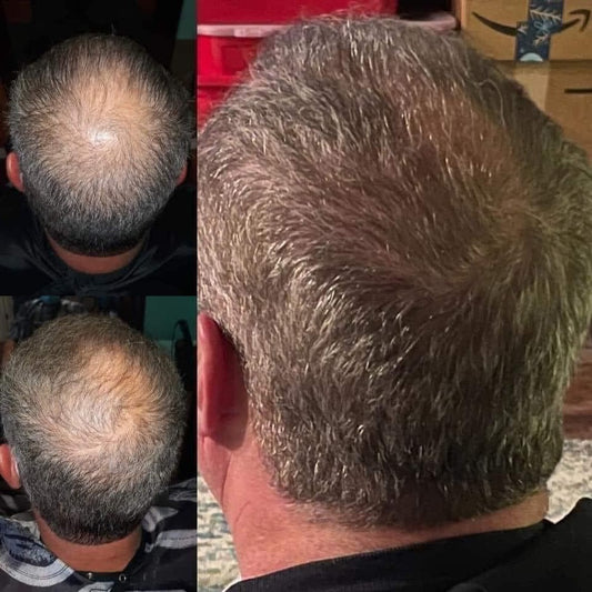 AgeLOC Hair & Scalp Shampoo & Conditioner