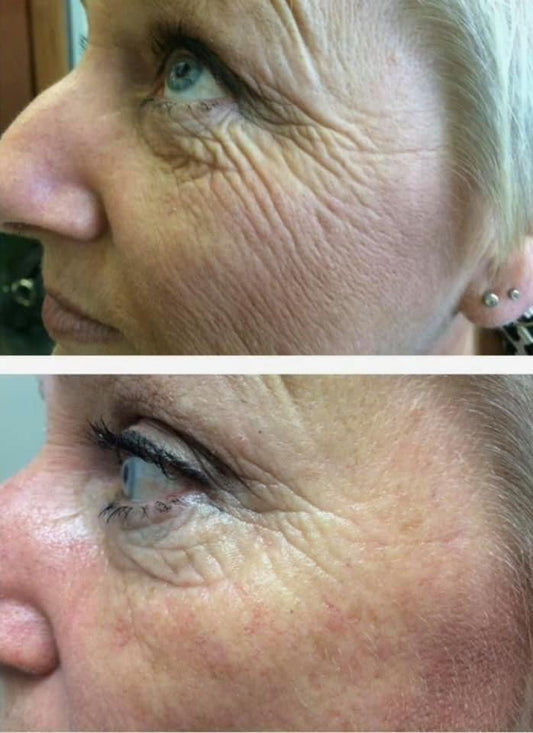 Tru Face Anti-Aging Uplifting Cream