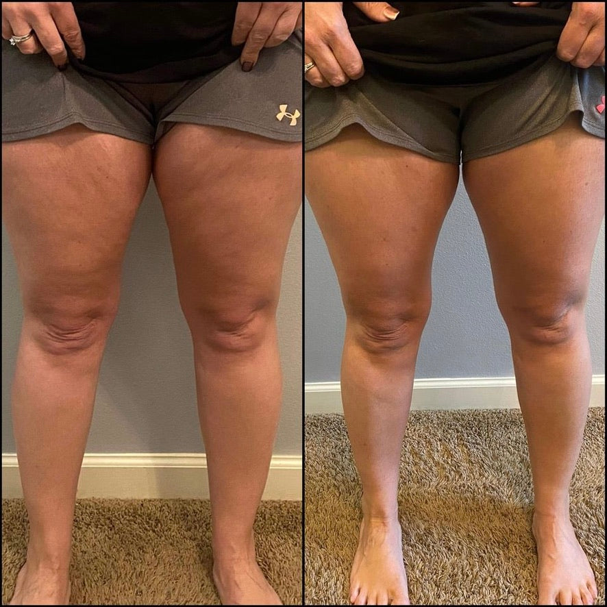 Dermatic Effects - Cellulite Firming Cream
