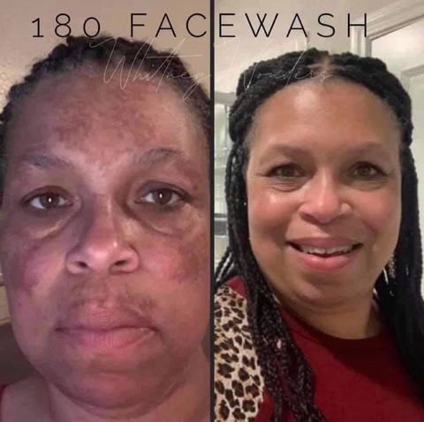180 Vitamin C Face Wash