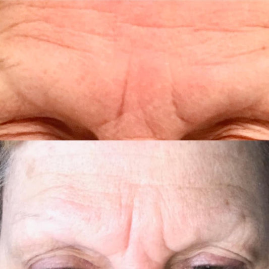 Tru Face Line Corrector