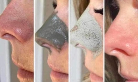 Glacial Marine Mud Mask