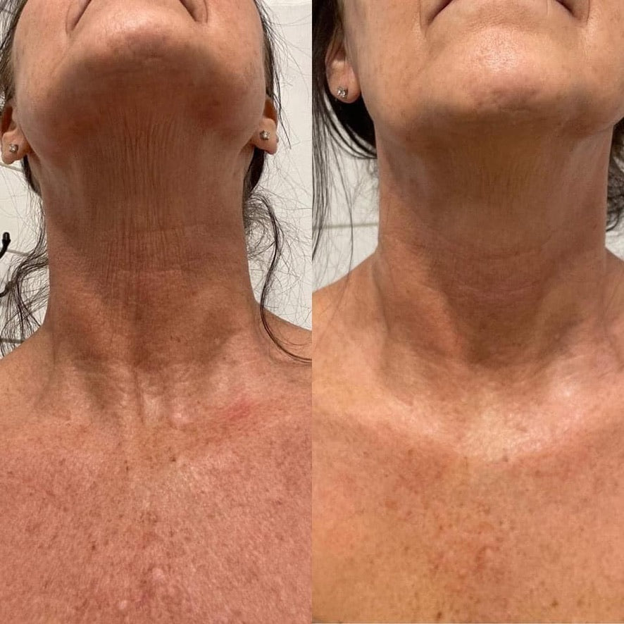 Dermatic Effects - Cellulite Firming Cream