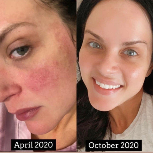 LumiSpa iO Essentials Kit