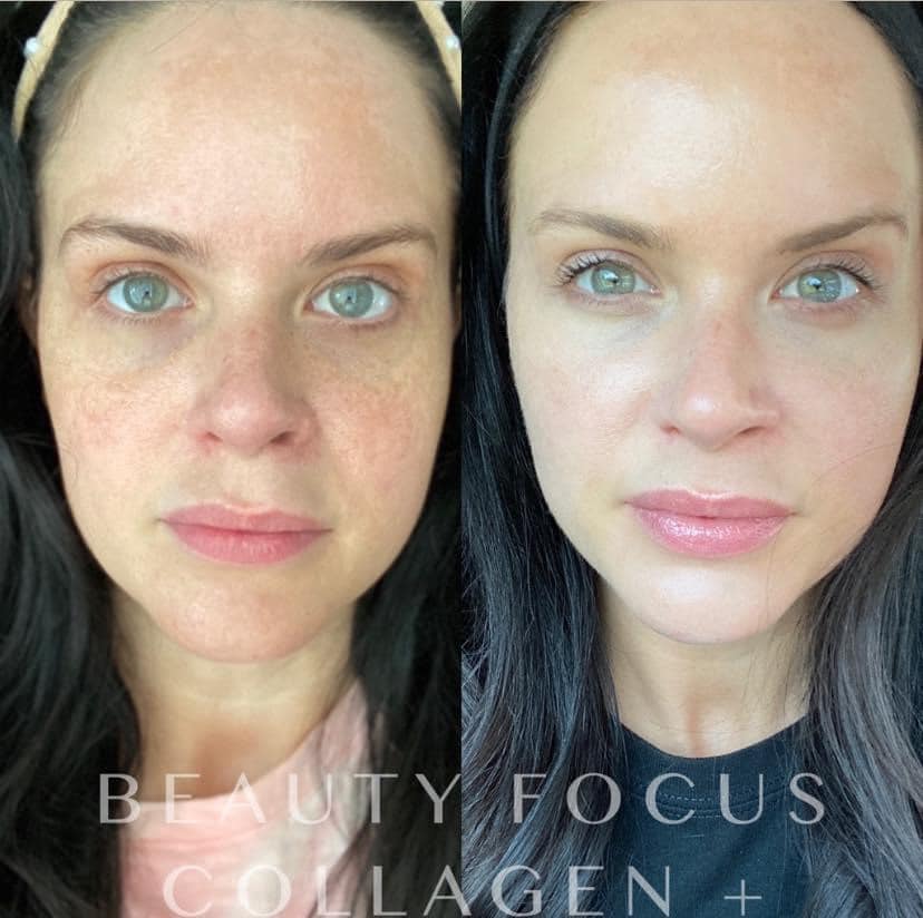 Beauty Focus Collagen+