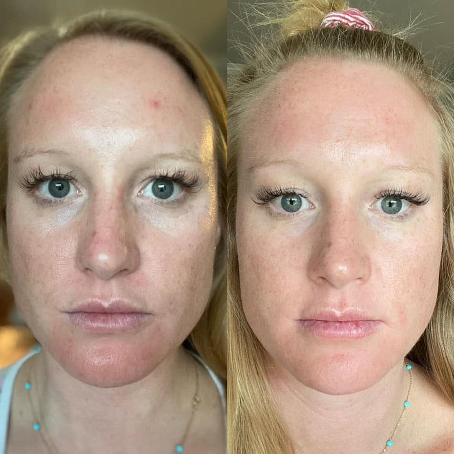Beauty Focus Collagen+
