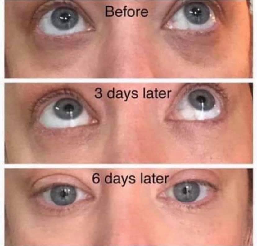 AgeLoc Ideal Eyes