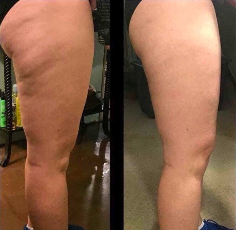 Dermatic Effects - Cellulite Firming Cream