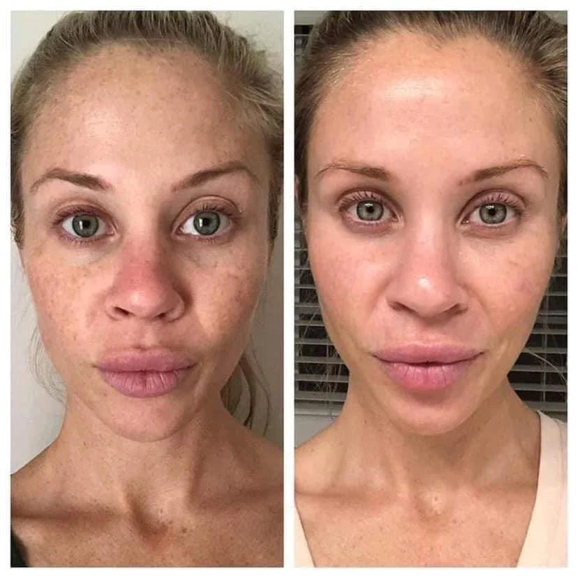 180 Vitamin C Face Wash